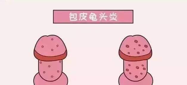 龟头炎表现症状