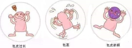 小孩包茎会影响发育吗