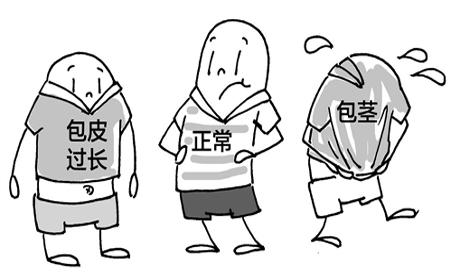 包茎手术后水肿