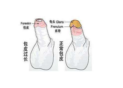 濮阳东方医院包皮手术切多少