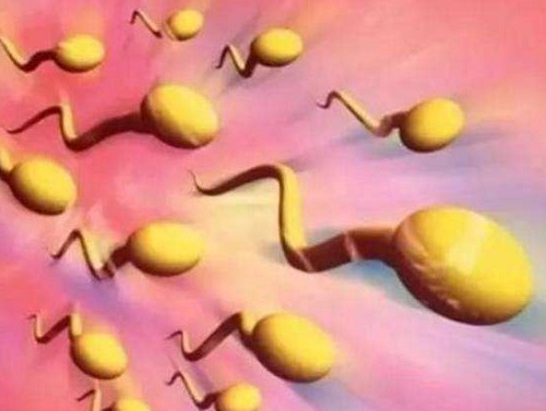 前列腺炎精子发黄